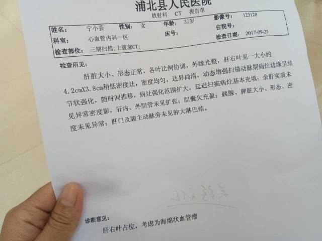 体检身体时发现得肝右血管瘤,4cm大左右,要怎么治疗,有没有相关的专家