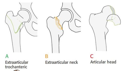上端以股骨头与髋臼构成髋关节,下端与 a target="_blank" href="
