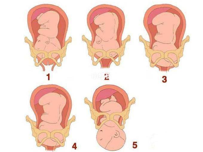 顺产宫口开"十指"究竟是什么感觉?