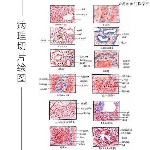 病理实验课切片汇总(1)