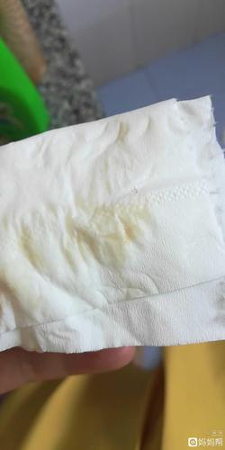 请问这样是褐色分泌物吗?图片有点恶心,不