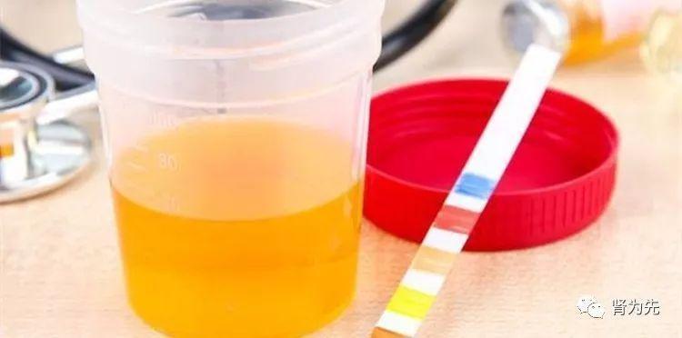 肾友查出尿蛋白3 ,医生却说"不用治"或"不用加药",怎么回事?