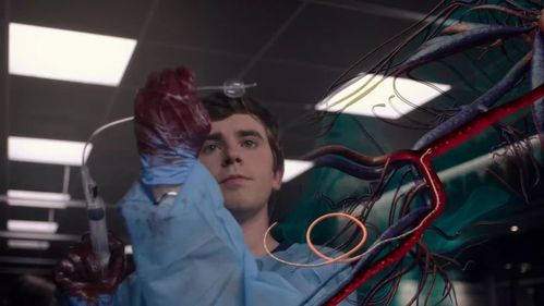 肖恩,医生,良医,亚伦,肖恩·墨菲