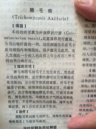 腋毛癣是怎么一回事?该如何治?