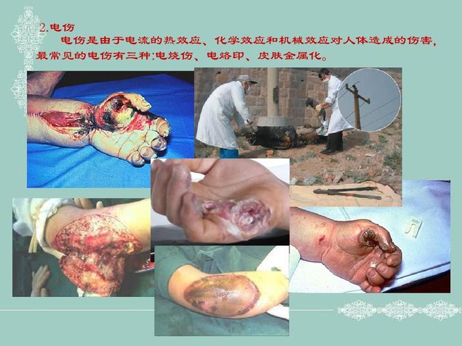 触电的危害与急救ppt