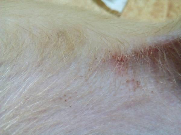 我家狗狗是毛囊炎吗