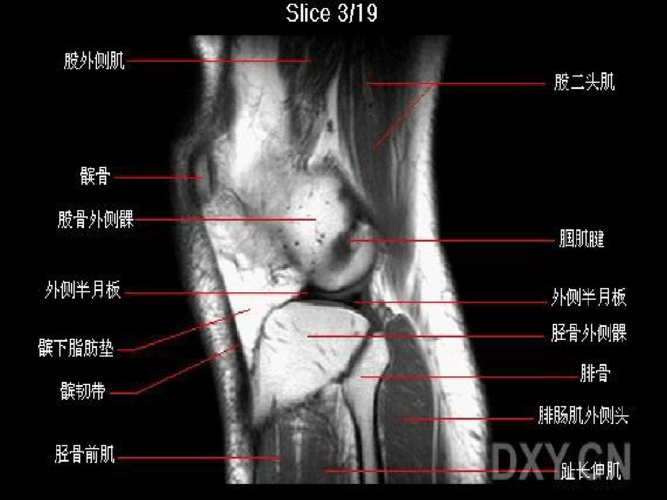 膝关节核磁共振ppt