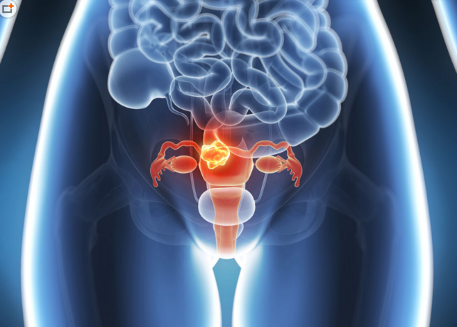 女性卵巢器官图片素材(图片id:418887)_-人体器官图-人物图片-图片