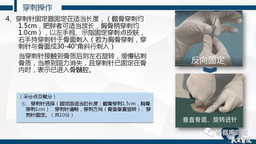 下,会因为臀部脂肪过多而很难触及到骨骼;而髂前上棘临床非常易于定位