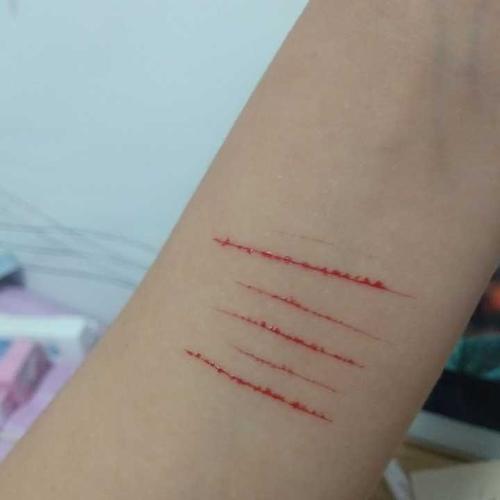 如何向朋友解释自残后的伤疤?