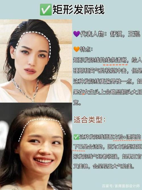 几种常见的发际线,你又是哪一种呢?几分钟教你植发如何选发际线