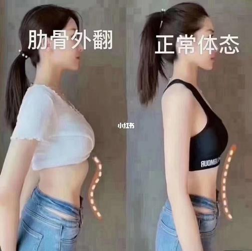 吉相骨雕科普宣: 93肋骨外翻的危害 16615体态不美观,明明不胖