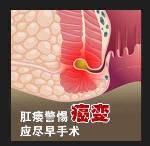 1,感染流脓:首先肛瘘感染发炎后,肛门疼痛剧烈,溃破后脓水污染内裤