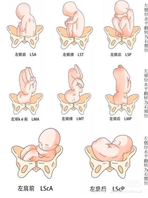 胎位方向_顺产_母婴_孕产经验