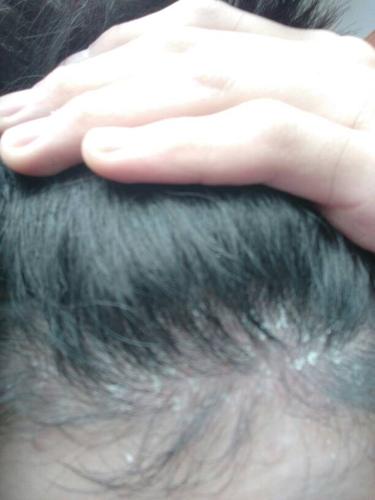 是头皮屑嘛?怕怕的