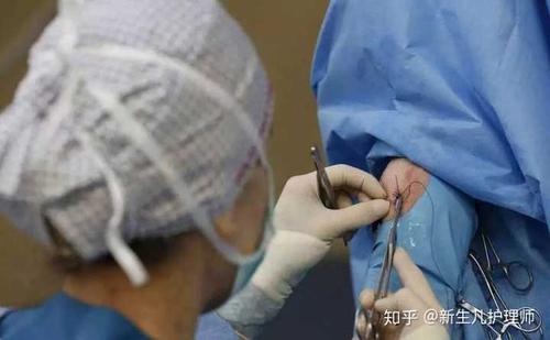 现在顺产会进行会阴侧切吗?