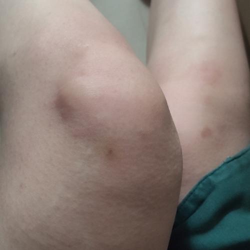 最开始的膝盖,一点点