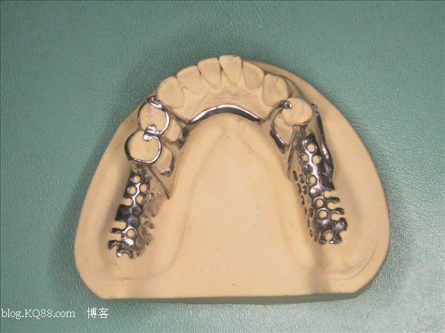 铸造支架义齿设计图谱收集一