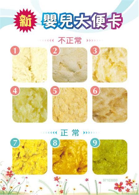 首页 育儿导航 新生儿 新生儿护理 宝宝「屎」坏?