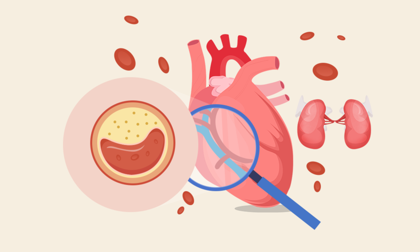 第26期:出现这3种症状,小心是血管动脉硬化!