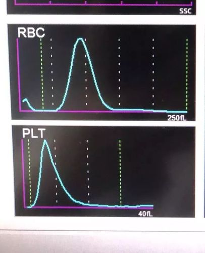 别做检验匠,血常规散点图带给我们的深刻启示!
