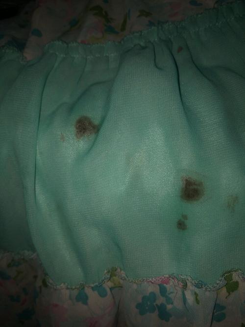 12周岁,没来月经初潮.有白带快一年.最近乳白色变稠.