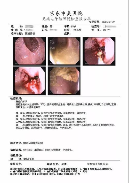 肠镜检查结果回示