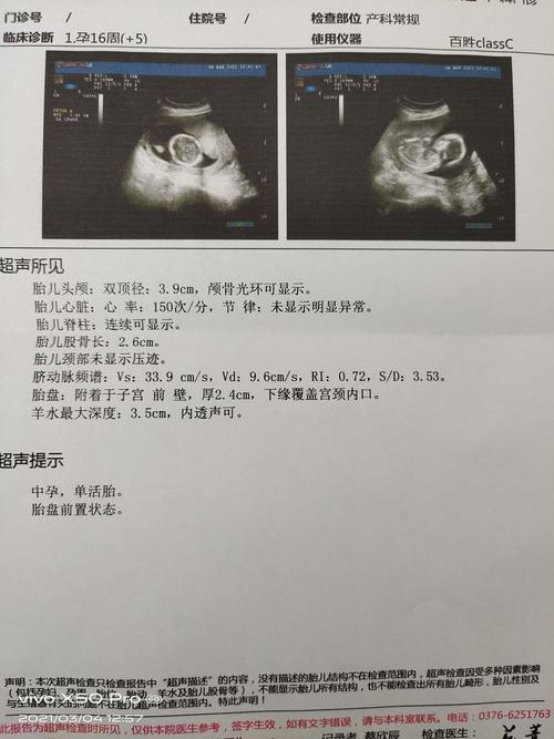 [试管婴儿]孕16周 5彩超报告显示胎盘下