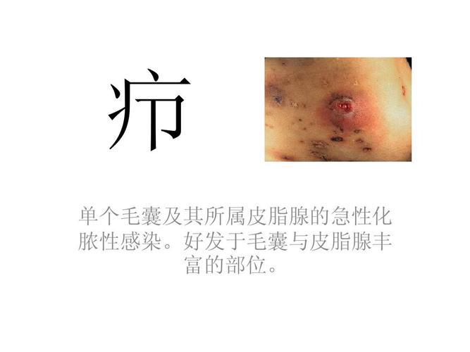 疖ppt