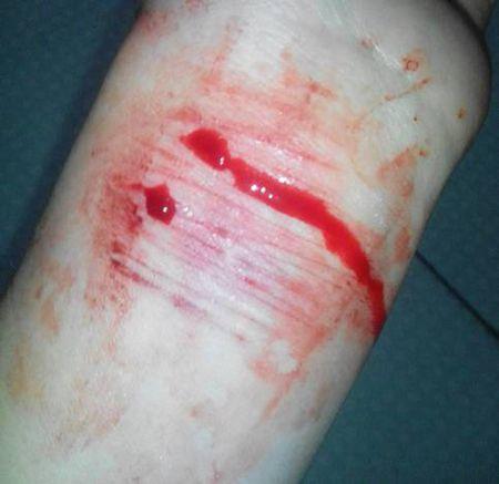 心情不好我就想自残, 用刀片割开皮肤 虽然有点痛 只有这样我才觉得