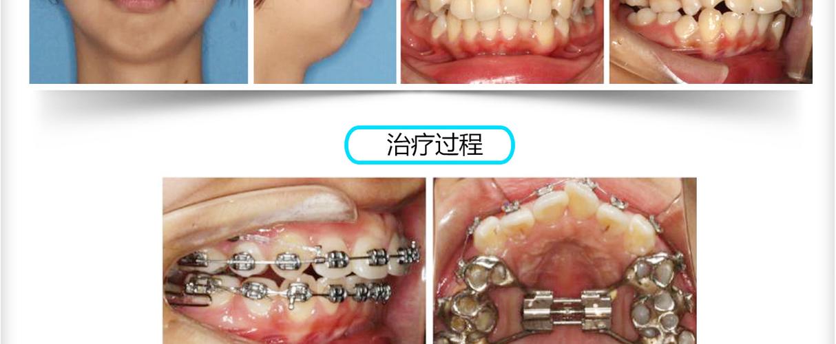 王增全