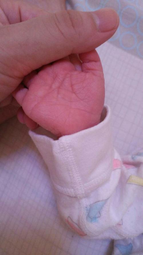 宝宝手掌中间有个方形的纹路怎么理解