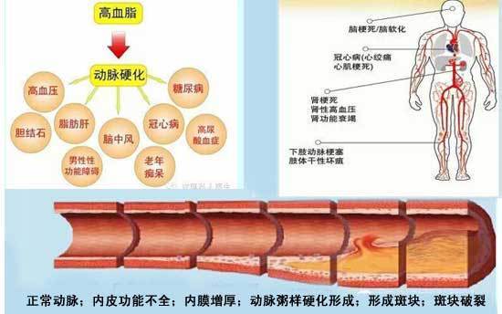避免血管内或外周血管内的血液堆积,起到抗 击心脏血管疾病的作用