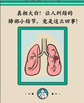 很多人发现结节谈结色变结节有何危害那些人会出现结节