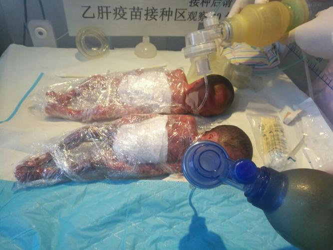 孕25周700g宝宝7个月啦!