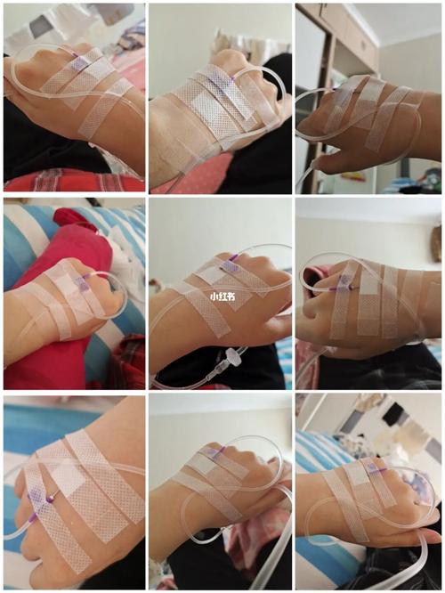 输液结束,还没好转,继续吃药._抑郁症_克隆_抑郁症化