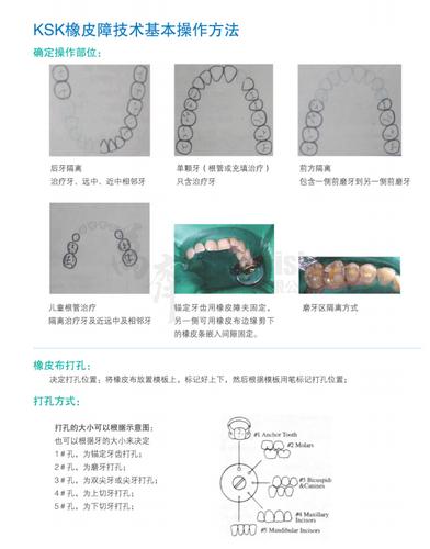 ksk橡皮障补充装