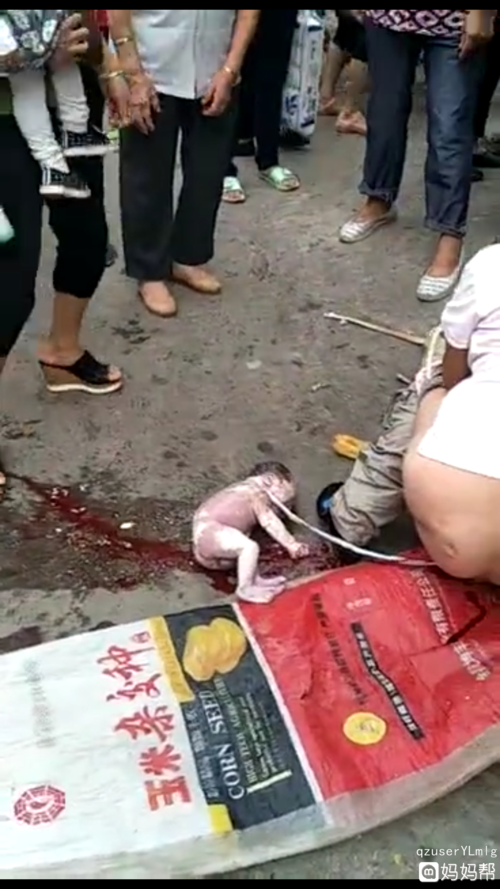街上生孩子