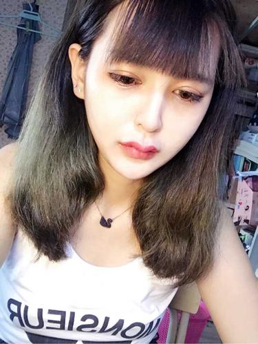 有没有什么方法缩减唇珠?看起来更正常?