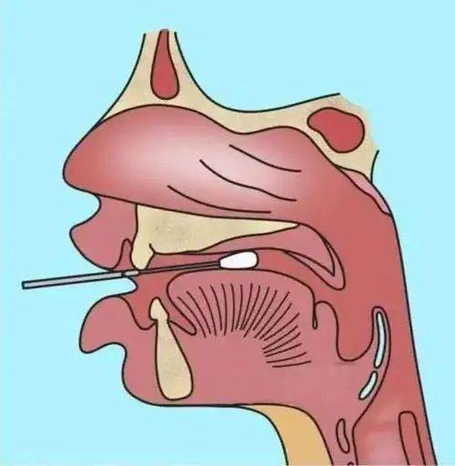 1477咽拭子口咽拭子鼻咽拭子肛拭子