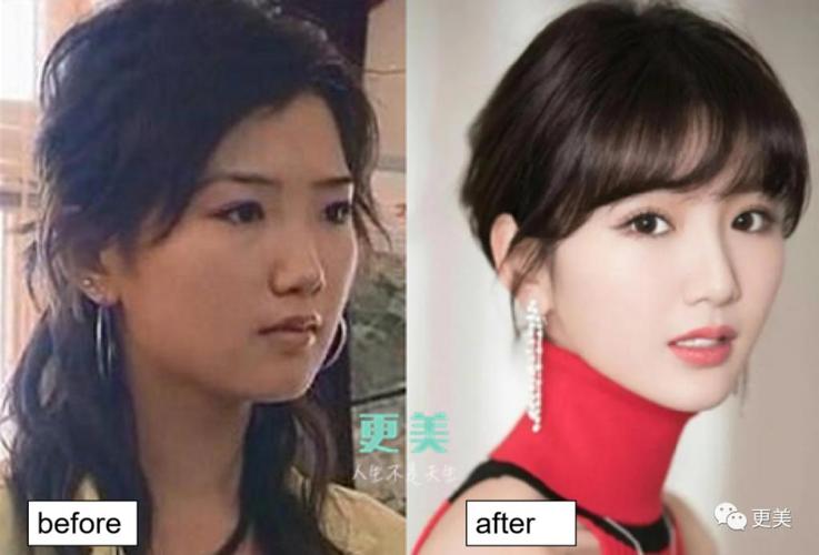 毛晓彤下颌进化史,不输杨幂?