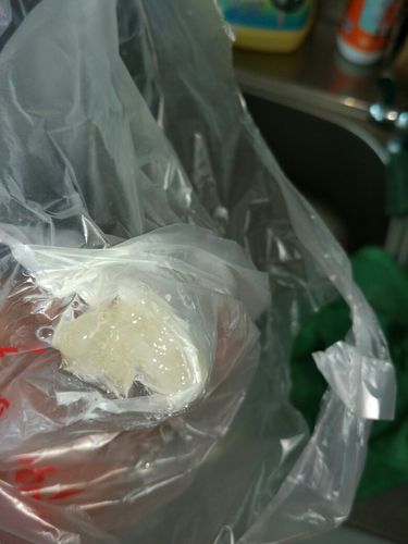 为什么痰是这种颜色