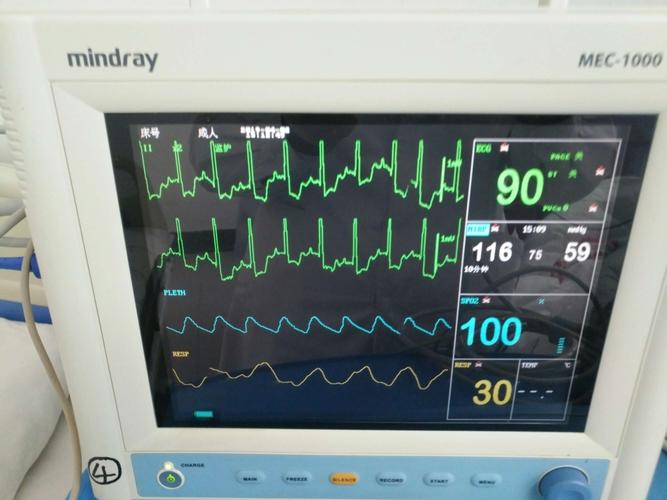 监护仪上也出现了心脏跳动的波形,是世上最美丽的图案,也是生命气息的