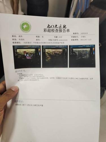 颌下淋巴结肿大,左侧大概4cm