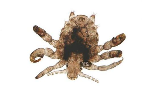 展开全部 阴虱是虱病的一种,是由寄生在人体阴毛和肛门周围体毛上的