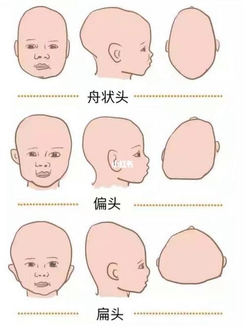 成功逆袭/教你如何舟状头睡出圆头_头型_枕头_定型枕