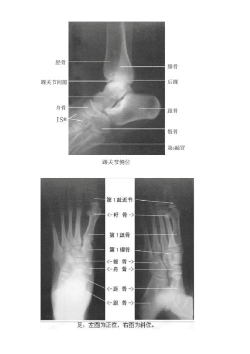 足部x光及解剖图