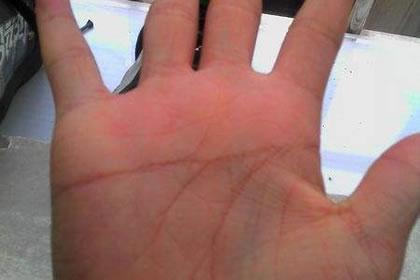 话说断掌有男左女右的区别之分吗