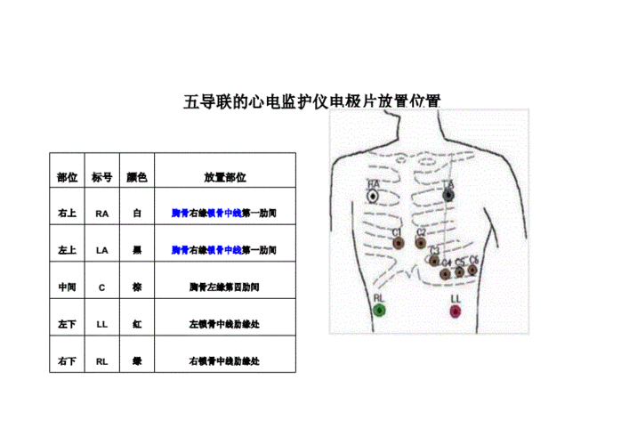 五导联的心电监护仪电极片放置位置docx12页
