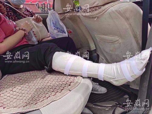 六安一女生上午高考散场下楼时不慎摔伤,疑似骨折